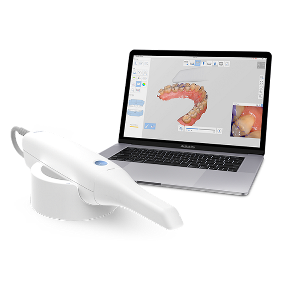 Современный сканер Medit i500 – шаг к совершенству стоматологии!