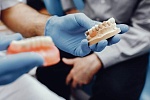 Какие протезы выбрать при отсутствии зубов?